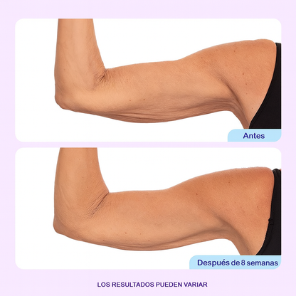 Elevante™ - Crema Esculpe y Tonifica Brazos