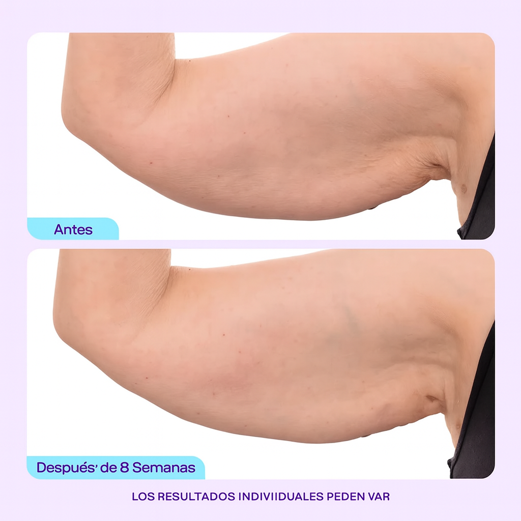 Elevante™ - Crema Esculpe y Tonifica Brazos
