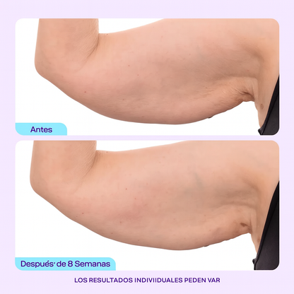 Elevante™ - Crema Esculpe y Tonifica Brazos